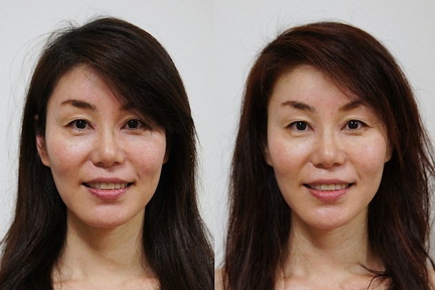モデルさんのBefore After