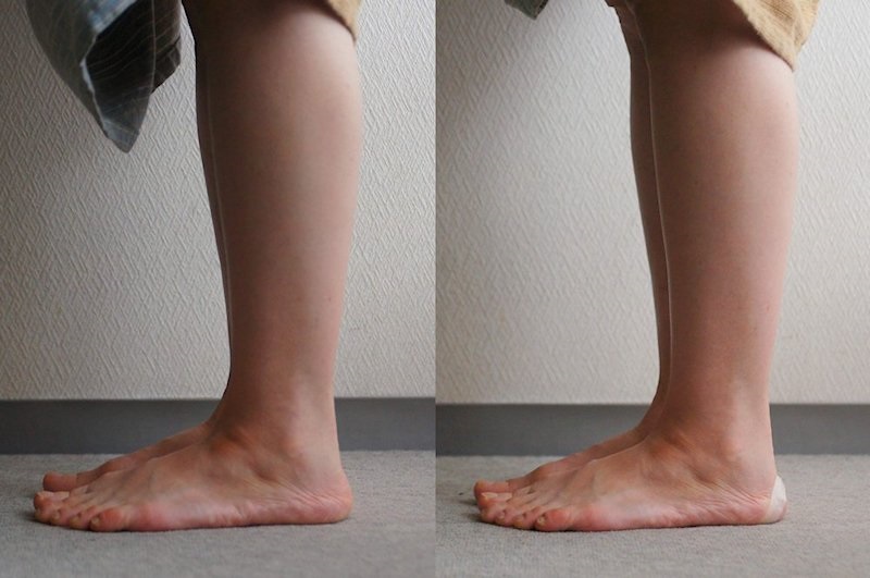 左軸足・右利き足の方の場合、軸足側から見たかかとの肉の側面の変化